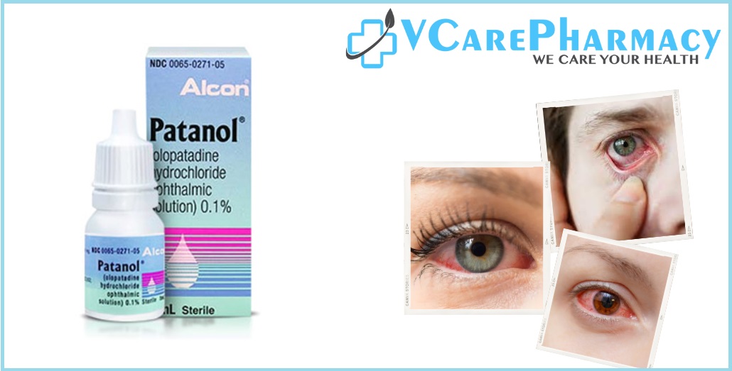 What is the Difference Between PATANOL and Pataday Eye Drops?